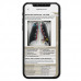 MDpocket® Pediatric Edition eBook